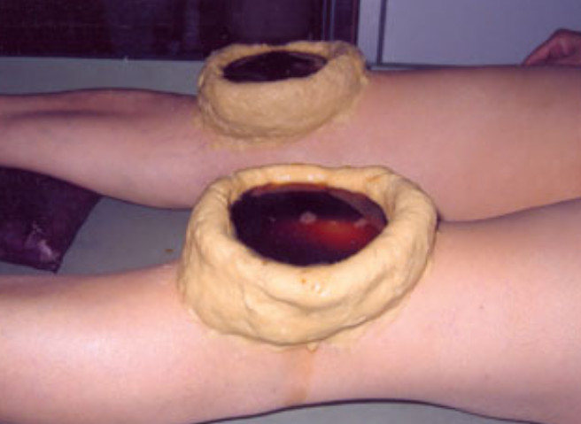 ATREYA AYURVEDA HOSPITAL AND PANCHAKARMA CENTRE