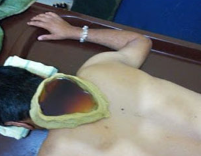 ATREYA AYURVEDA HOSPITAL AND PANCHAKARMA CENTRE